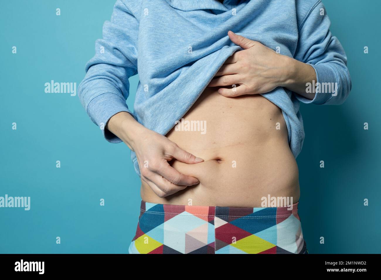 Eine Frau zeigt ihr Übergewicht auf dem Bauch, sie hält sich für fett. Psychologisches Konzept. Nahaufnahme Stockfoto