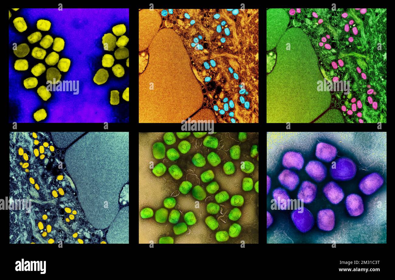 Ein Composite aus Bildern des Affenpockenvirus. Eine optimierte und verbesserte einzigartige Composite-Version von sechs Rasterelektronenmikrographiebildern, Credit: NIAID Stockfoto