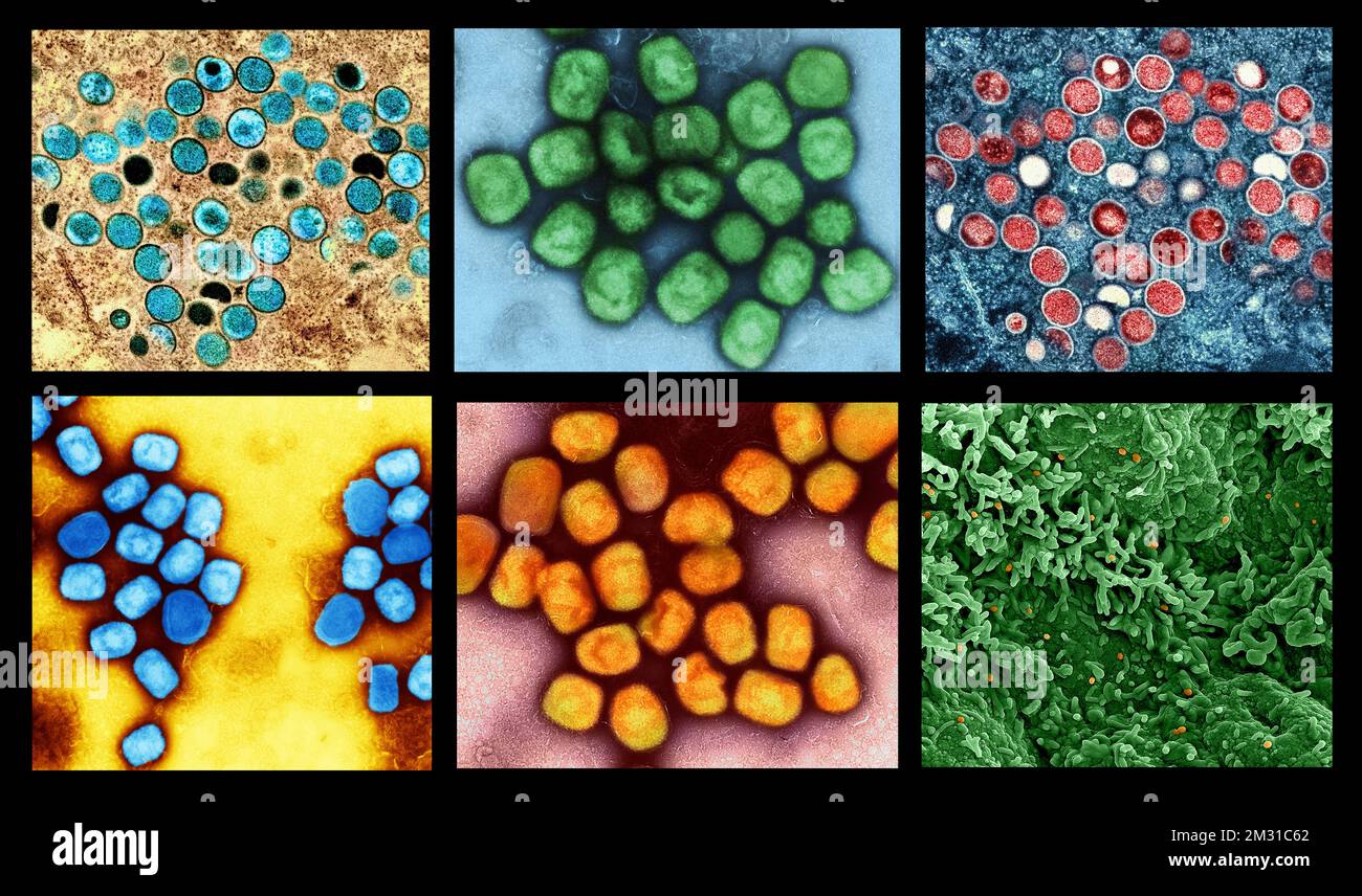 Ein Composite aus Bildern des Affenpockenvirus. Eine optimierte und verbesserte einzigartige Composite-Version von sechs Rasterelektronenmikrographiebildern, Credit: NIAID Stockfoto