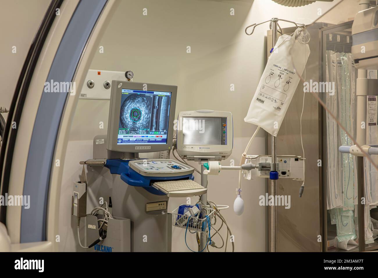 Istanbul, Türkei - 20. September 2022 ; Herzoperationssaal. Komplexe Herzchirurgie, Herz-Kreislauf-Chirurgie, moderne Medizin. Röntgenmonitore. Stockfoto