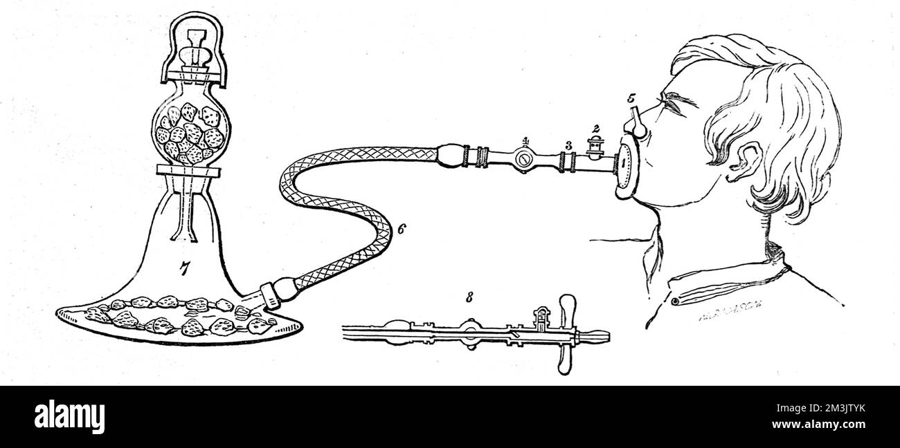 Ein Diagramm, das eine Methode zur schmerzlosen Durchführung chirurgischer Operationen zeigt. Ein Schwefeldampf wurde eingeatmet, und innerhalb weniger Minuten wurde der Patient narkotisiert. Datum: 1847 Stockfoto