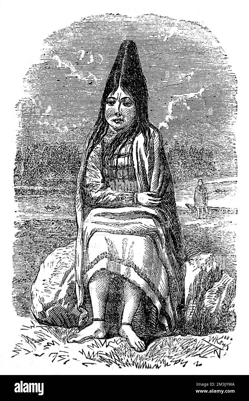 Indianische Ureinwohner mit konischem Kopf, 1863. Stockfoto