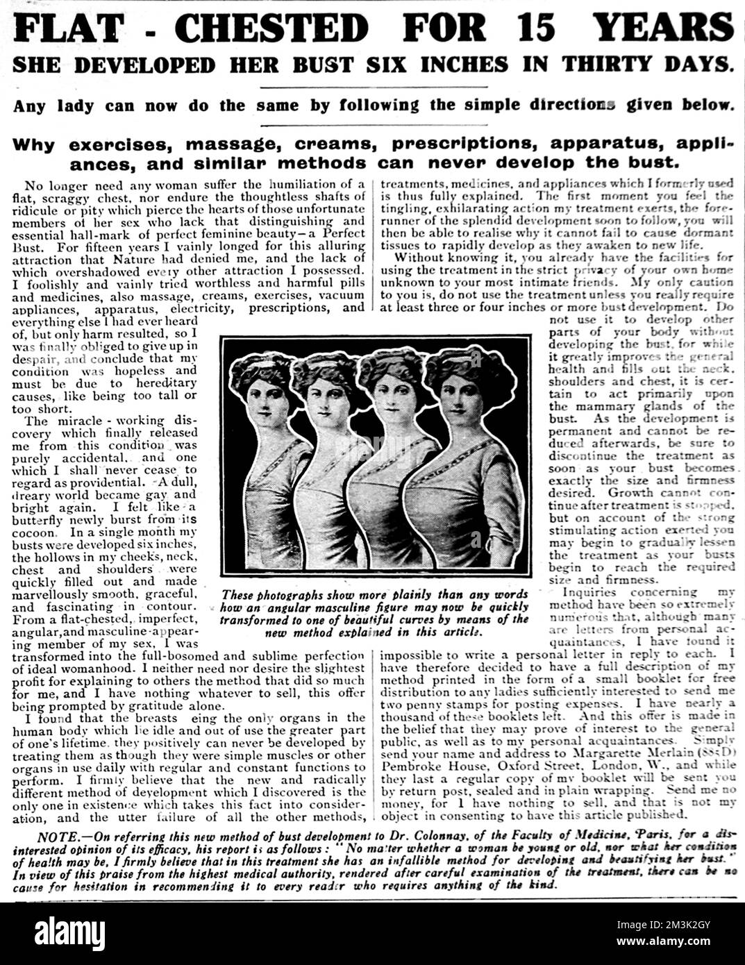 Werbung für ein in Großbritannien verkauftes Produkt zur Verbesserung der Büste, 1916. Die Anzeigenüberschrift lautet: „Seit 15 Jahren flachbrüstig, hat sie ihre Büste in 30 Tagen um 10 cm entwickelt“. Stockfoto