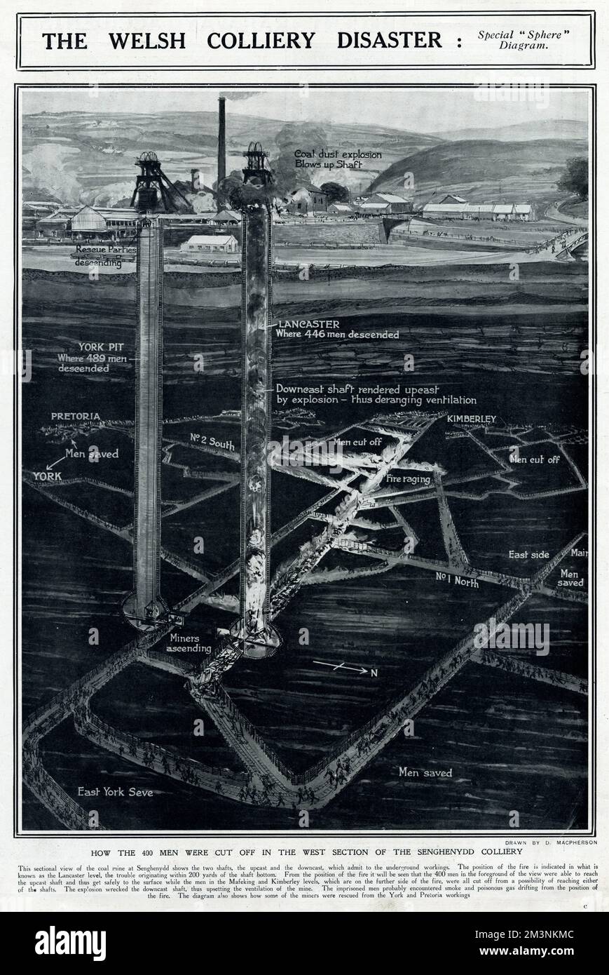 400 Männer wurden im westlichen Teil der Senghenydd-Grube abgeschnitten, nahe Caerphilly. Die Explosion wurde wahrscheinlich durch die Feuerdampf ausgelöst, möglicherweise durch elektrische Funken von Anlagen wie elektrischen Signalanlagen. Die anfängliche Explosion störte den auf dem Boden vorhandenen Kohlestaub und verursachte eine Wolke, die sich dann ebenfalls entzündete. Durch die Stoßwelle vor der Explosion wurde noch mehr Kohlestaub freigesetzt, so dass die Explosion effektiv selbstbetankend war. 439 Bergleute wurden getötet, es war der schlimmste Bergbauunfall in Großbritannien. Datum: 14. Oktober 1913 Stockfoto