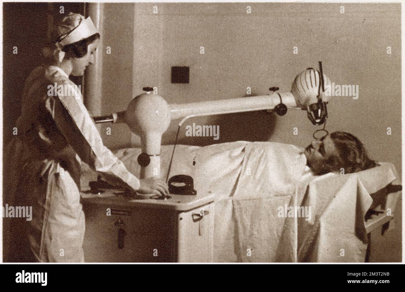 Ein Heilmittel für Gesichtsfehler: Der Siemens-Reiniger Apparat, Behandlung mit Röntgenstrahlen, um alles von einer winzigen Warze bis zu einer weit verbreiteten Hautkrankheit zu unterstützen. Datum: 1933 Stockfoto