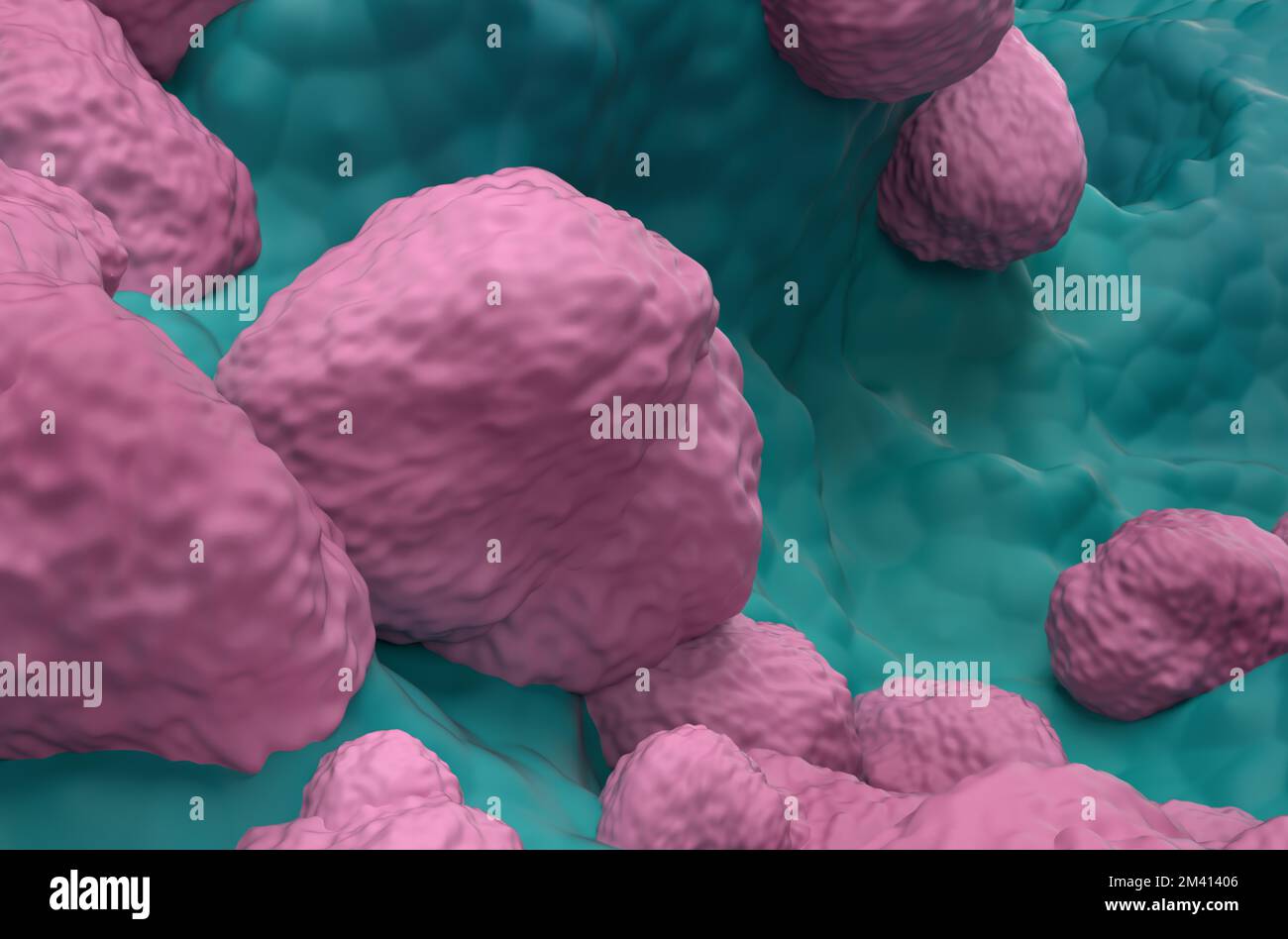 Nicht-kleinzelliges Lungenkarzinom (NSCLC) im Lungengewebe - Super-Nahaufnahme 3D-Abbildung Stockfoto