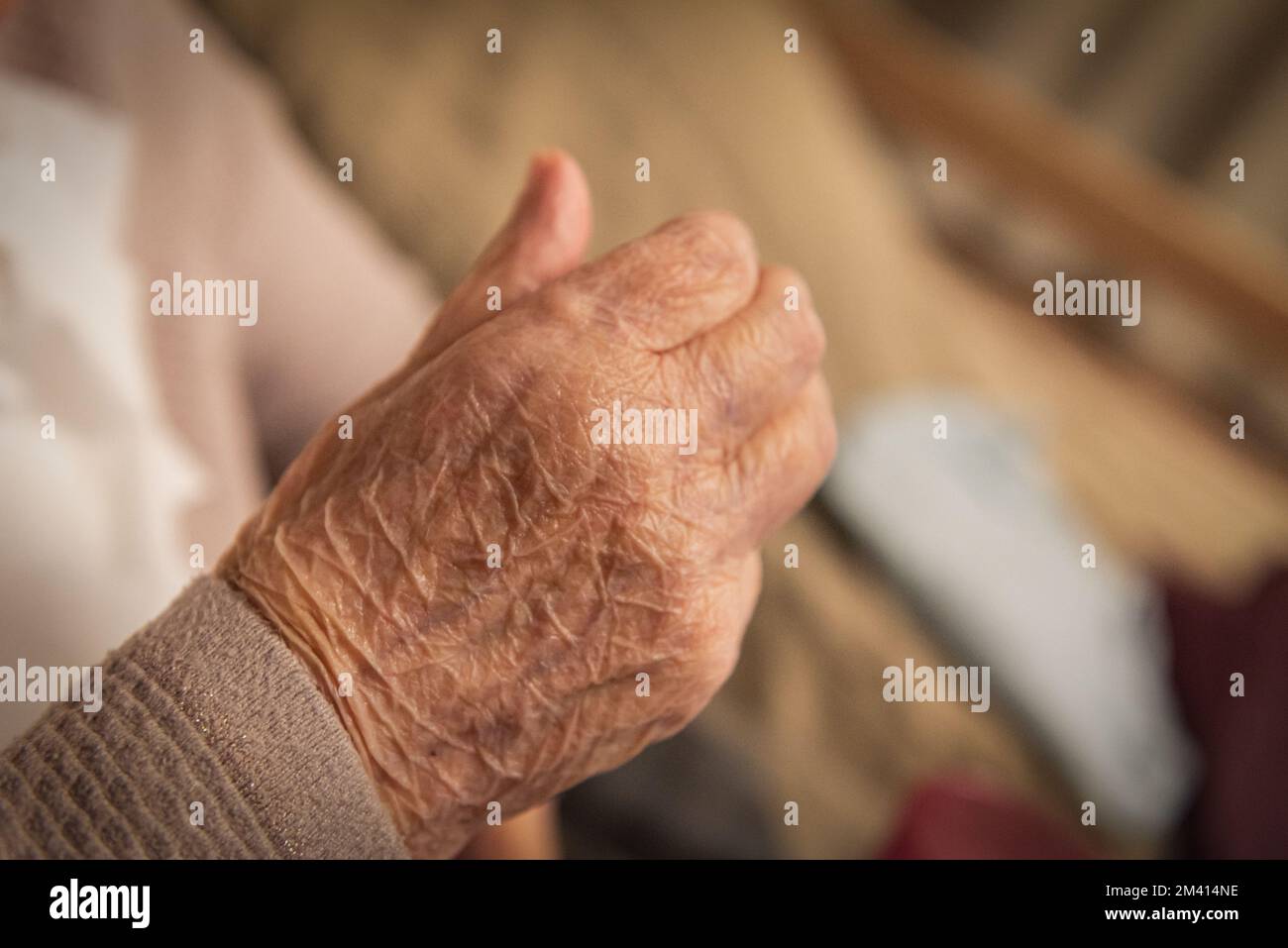 Morbus Parkinson. Die Hand einer älteren Frau Stockfoto