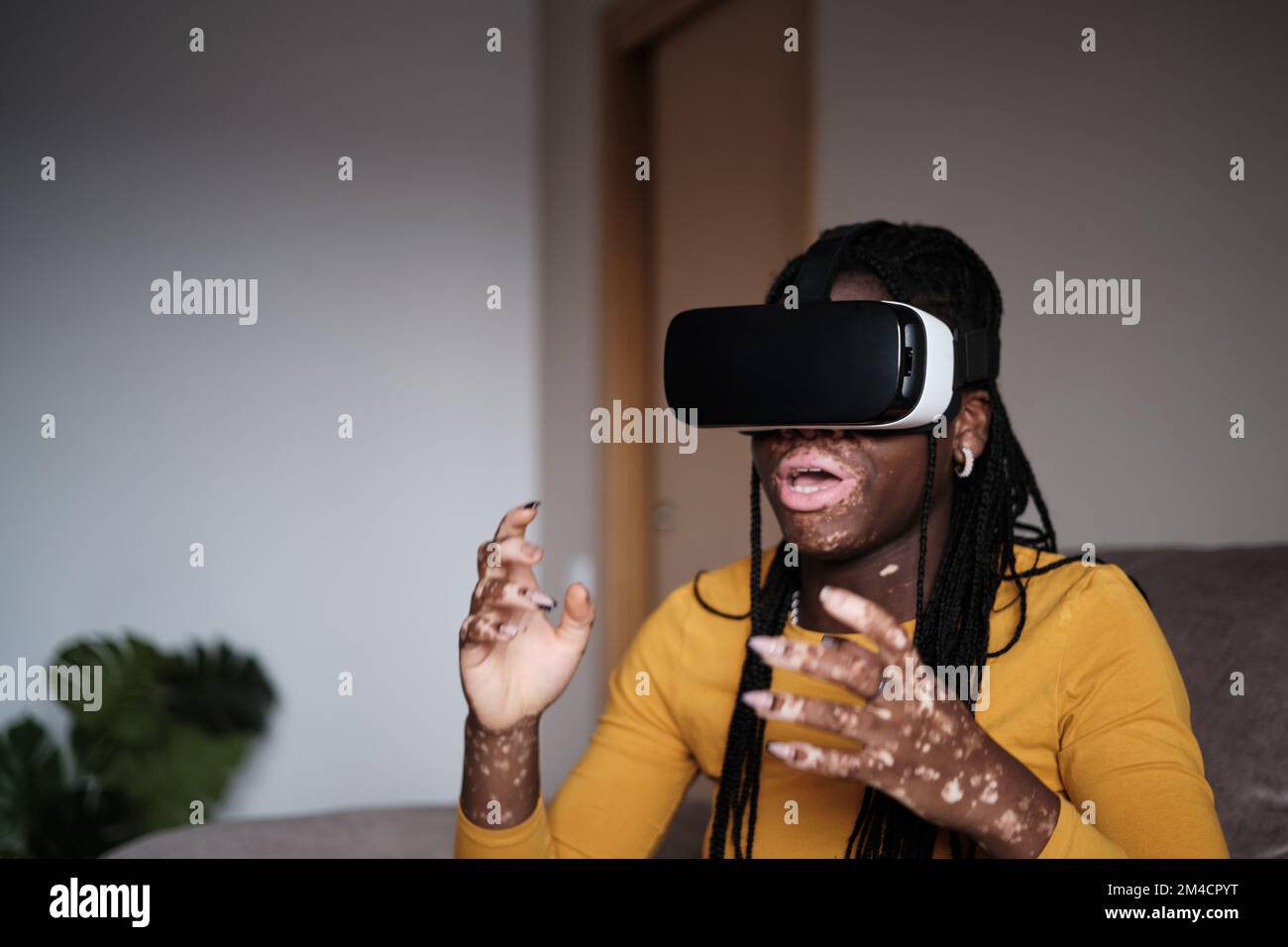 Überwältigende schwarze Frau mit Vitiligo-Haut in VR-Headset Stockfoto
