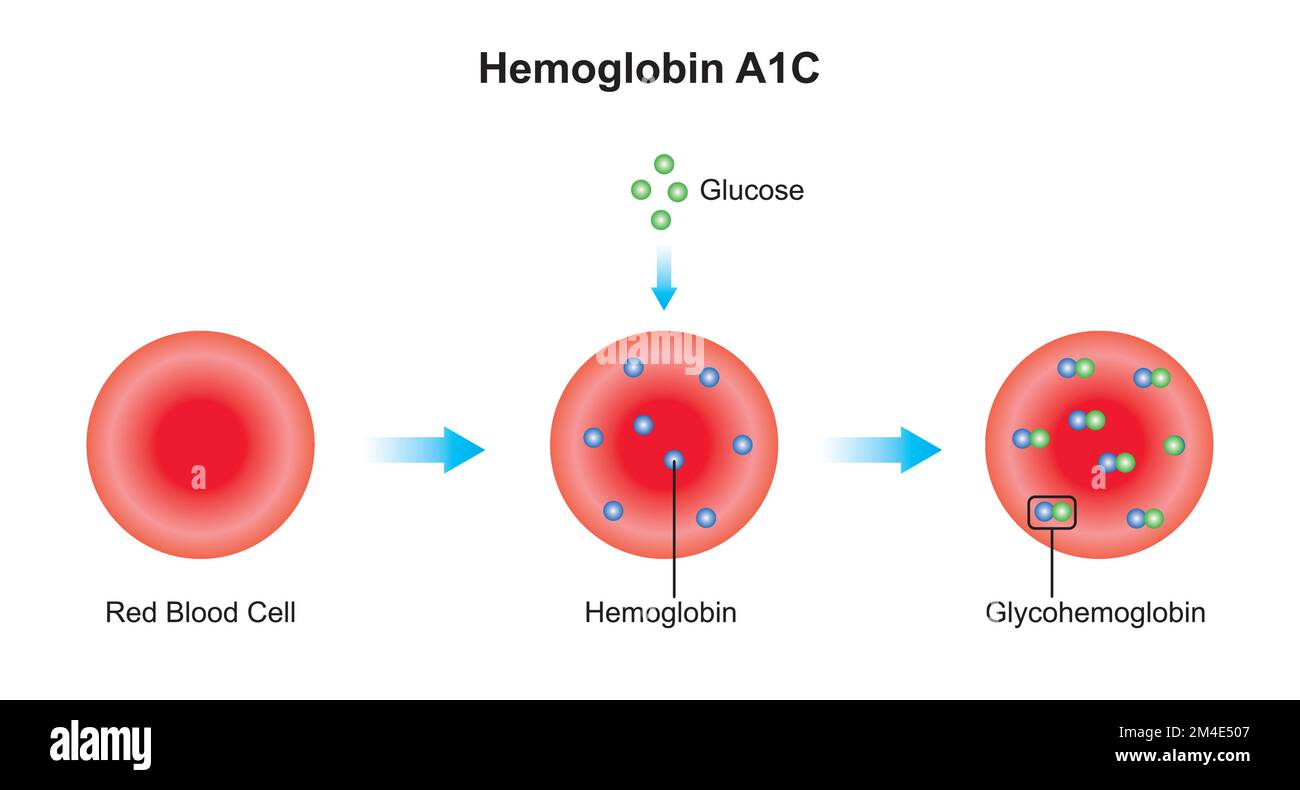 Wissenschaftliche Gestaltung der glykosylierten Hämoglobinbildung. Bunte Symbole. Vektordarstellung. Stock Vektor