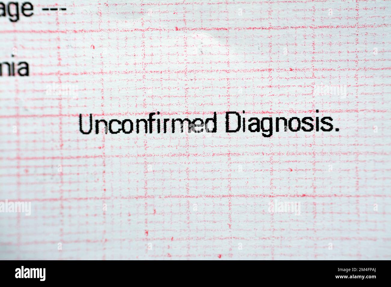 EKG-EKG-Papier, das unbestätigte Diagnosen von abnormen elektrischen Herzimpulsen und Myokardischämie, abnorme EKG-Konzeption, zeigt Stockfoto