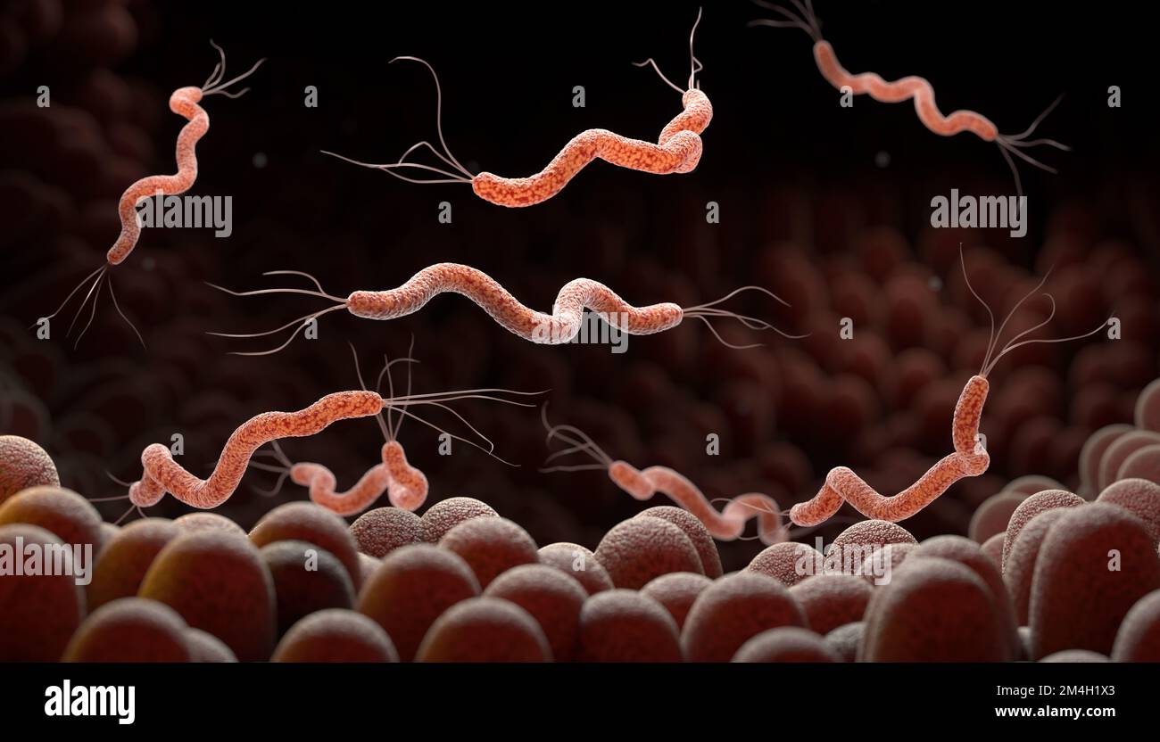 Spirillumbakterien sind die Ursache von Magengeschwüren oder bakterieller Diarrhoe , Keiminfektion , 3D Abbildung Stockfoto