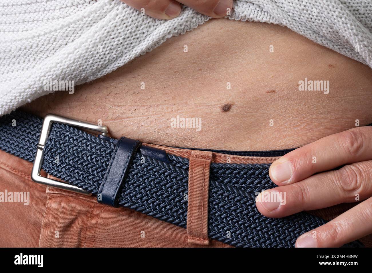 Makro eines Maulwurfs an der Leiste eines Weißen. Von Hand angehobene Gürtel- und Pullover-Details. Zum Begriff Melanom oder Melasma durch Sonnenstrahlung Stockfoto