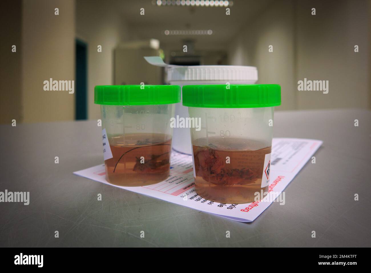 Gewebeproben werden zur anschließenden Untersuchung durch einen Pathologen im Krankenhaus in Formalin gelegt Stockfoto