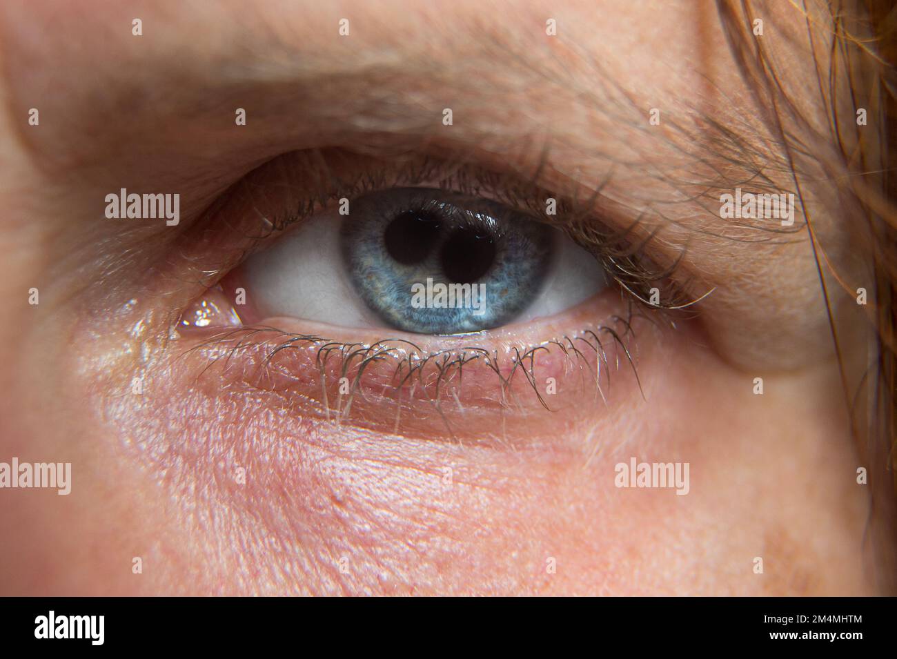 Makro eines weiblichen blauen Auges mit Polycorie, Pupillenverdopplung. Seltener Fall von Auge mit zwei Pupillen Stockfoto