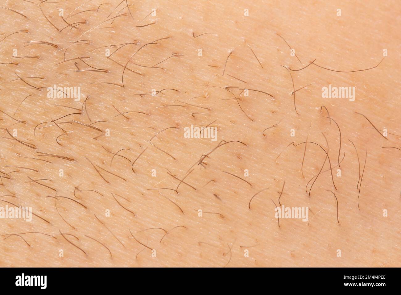 Draufsicht Haut menschliches Haarmakro. Nahaufnahme von frischem, nachwachsendem Haar Stockfoto