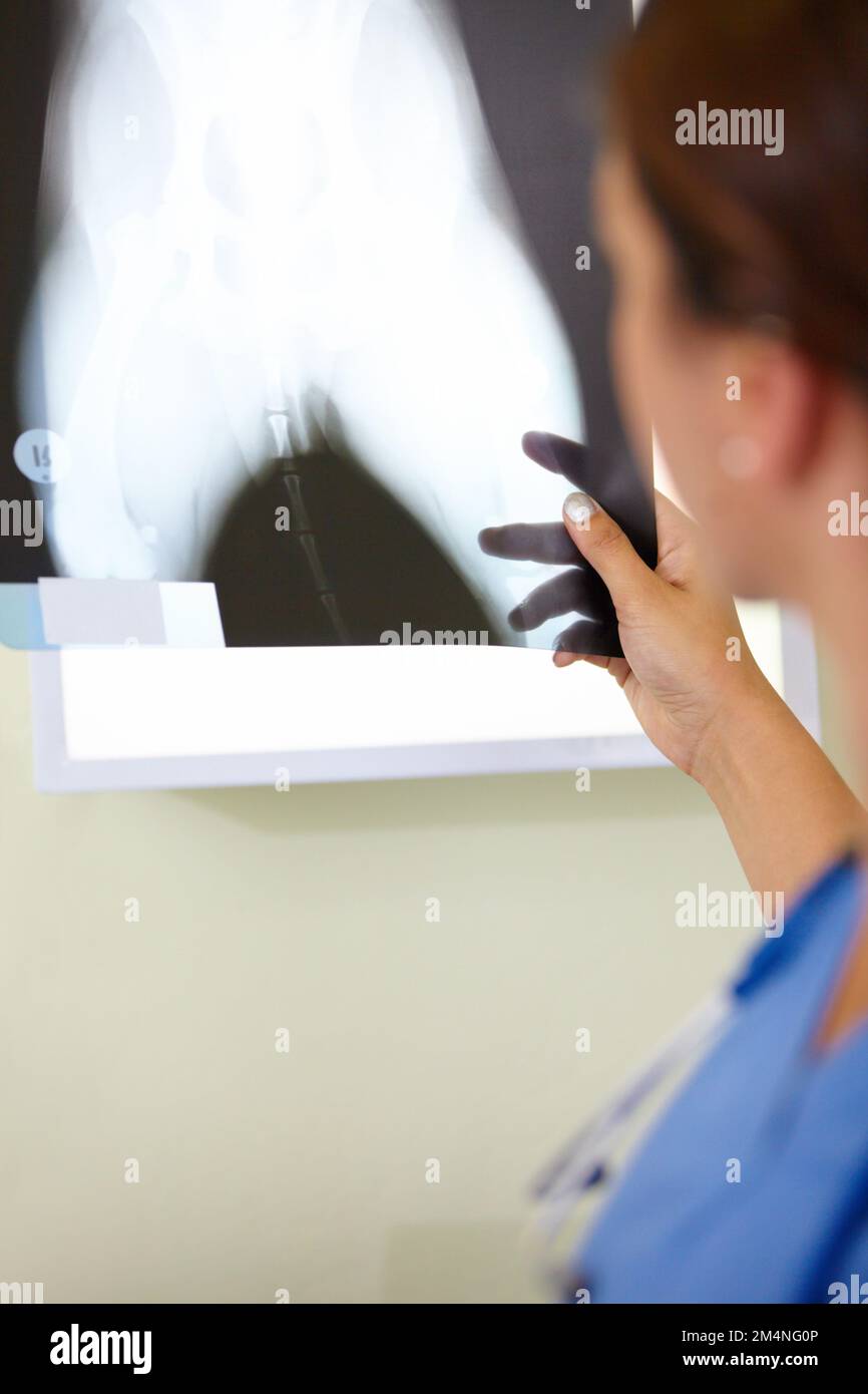 Um es richtig zu machen, müssen wir sehen, was falsch ist. Eine Ärztin, die sich ein Röntgenbild ansieht. Stockfoto