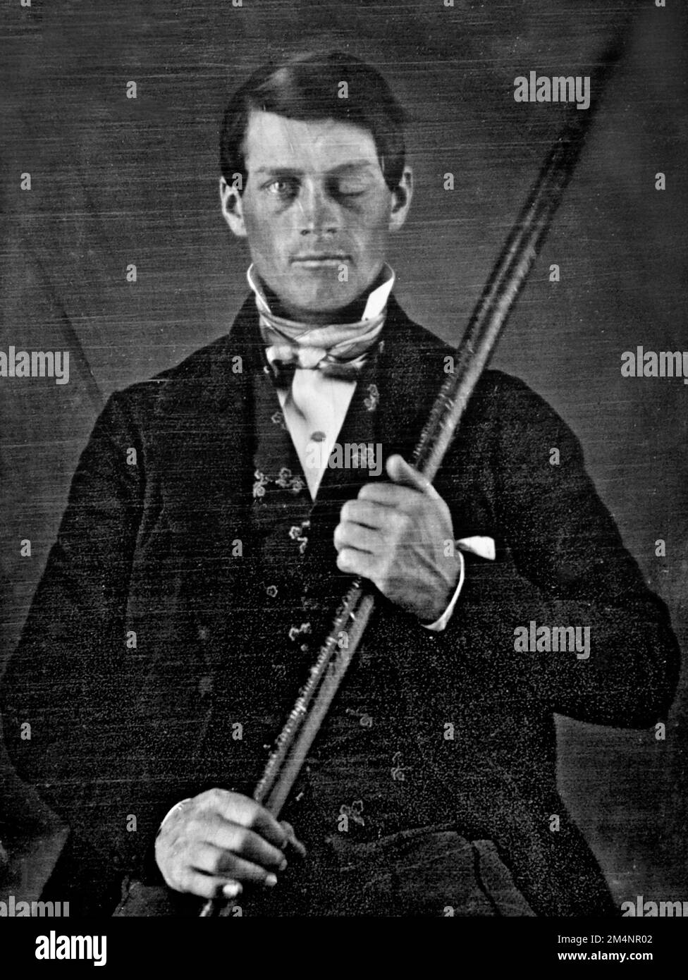 Phineas Gage. Foto von Phineas P. Gage (1823–1860), einem amerikanischen Vorarbeiter für den Bau von Eisenbahnstrecken, der für sein unwahrscheinliches Überleben eines Unfalls bekannt ist, bei dem ein großer Eisenstab vollständig durch seinen Kopf getrieben wurde und einen Großteil des linken Stirnlappens seines Gehirns zerstörte. Stockfoto