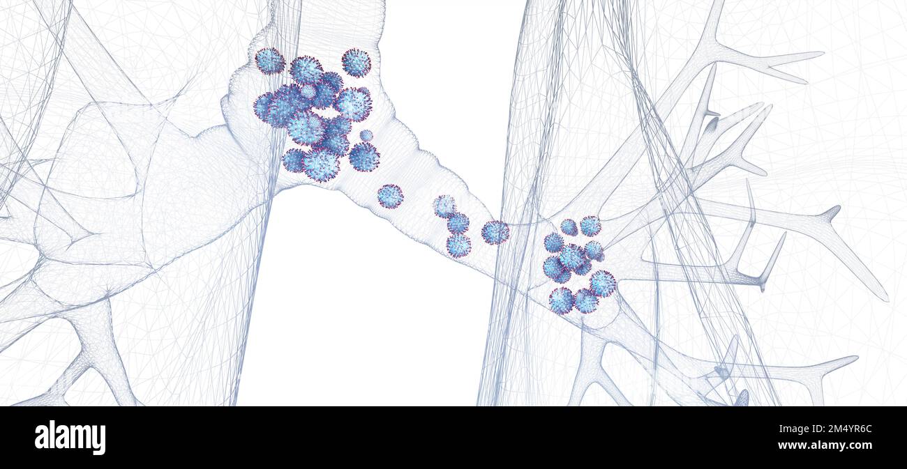 Partikel des Respiratory Syncytial Virus (RSV), 3D-Darstellung. RSV verursacht Atemwegsinfektionen. Stockfoto