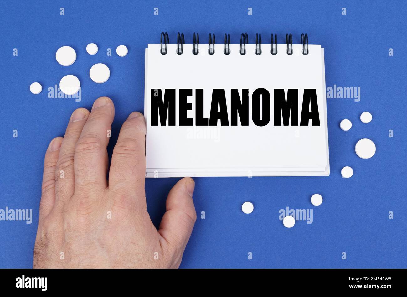 Medizinisches Konzept. Auf der blauen Oberfläche der Tablette eine Hand und ein Notizblock mit der Aufschrift MELANOM Stockfoto