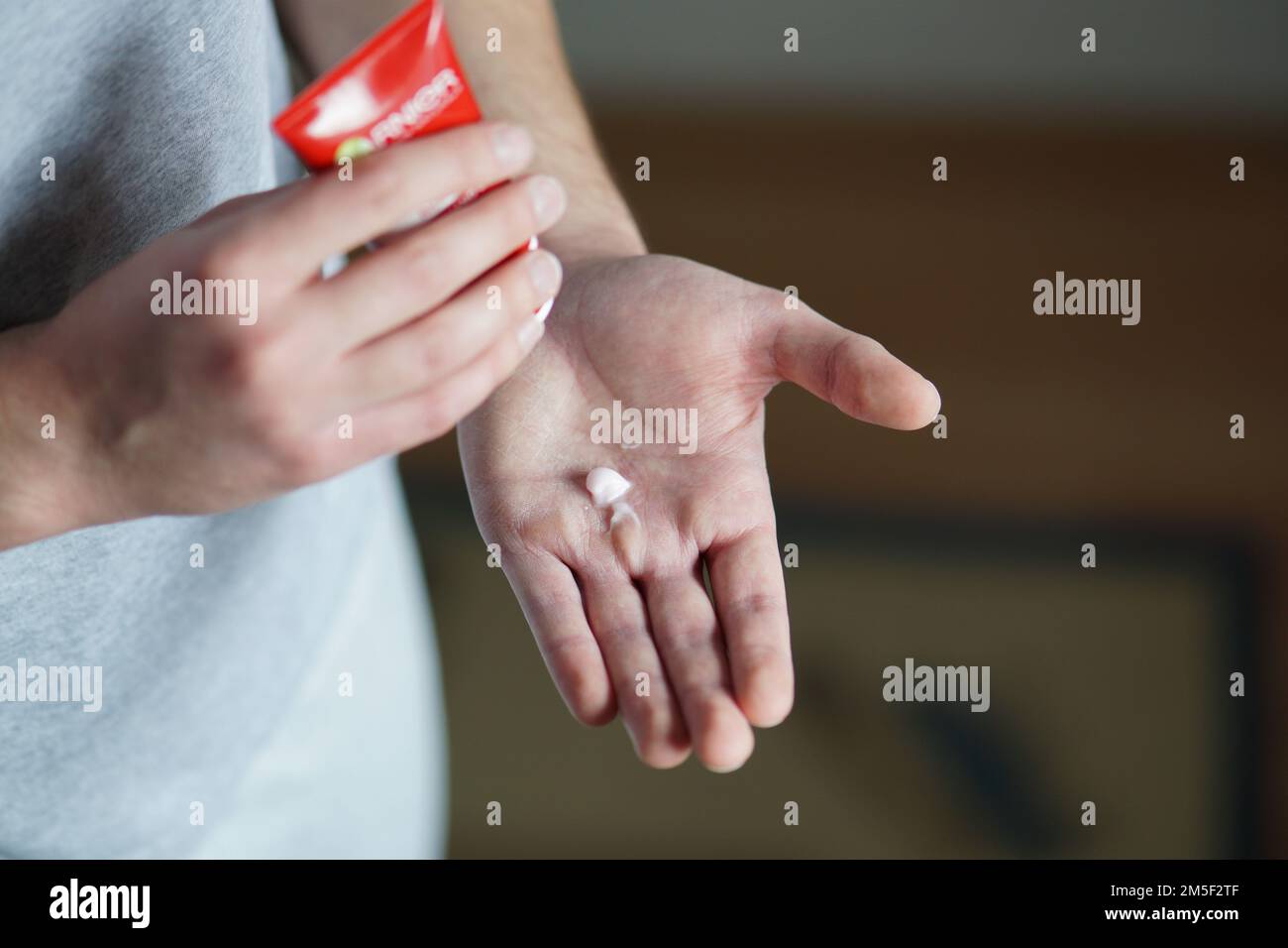 Trockene männliche Hände. Ein Mann, der Handcreme auf seine trockenen Hände legt. Stockfoto