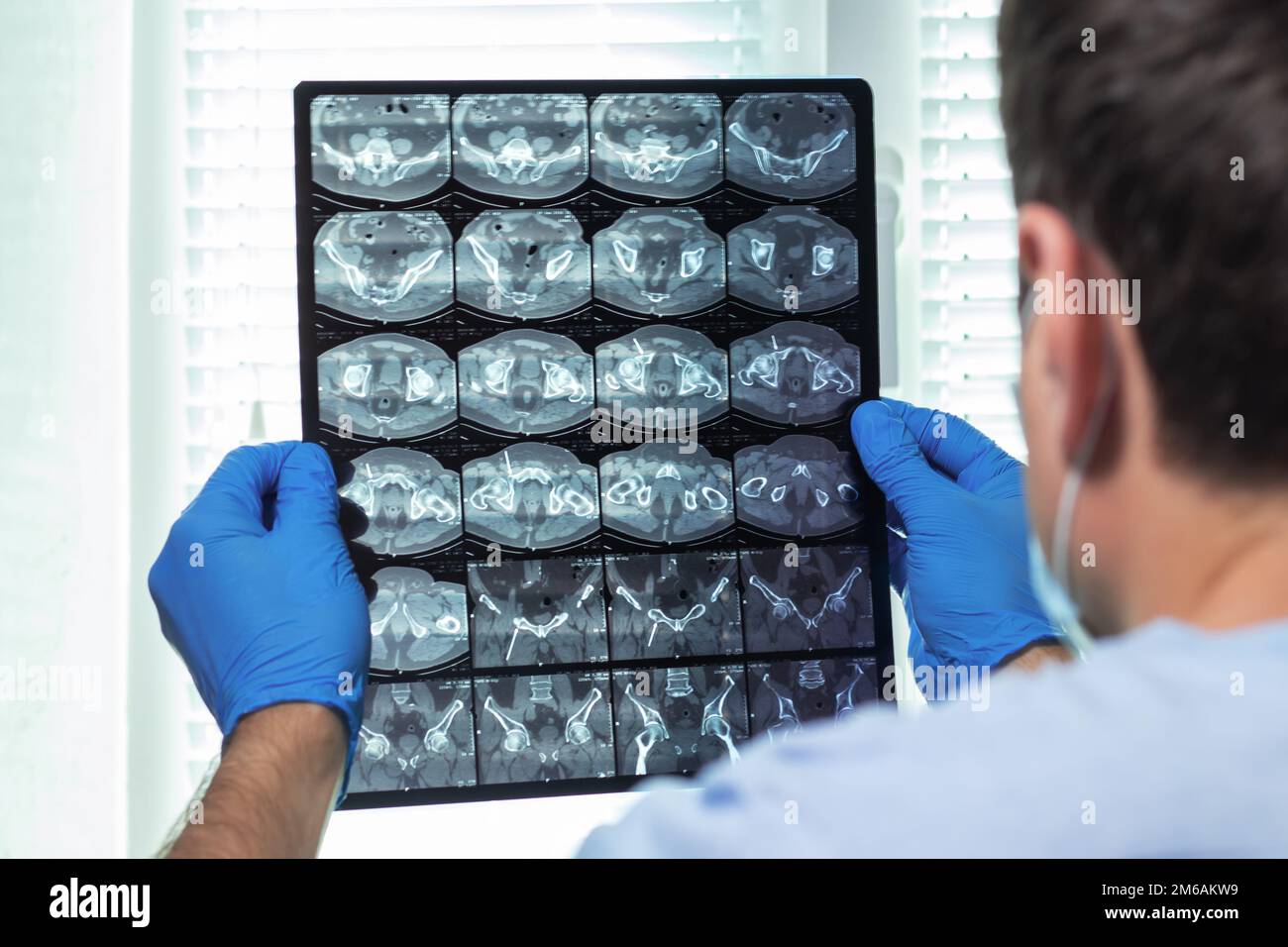 Arzt aufmerksam untersucht die MRT der Patienten scannen Stockfoto