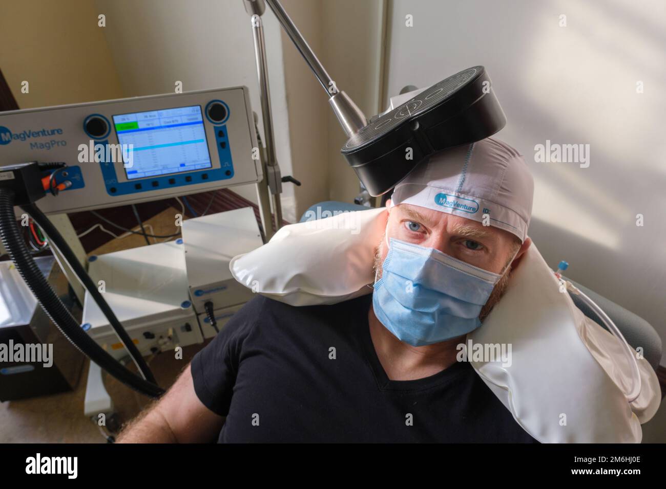 Montreal, Kalifornien - 15. november 2022: Patient unterzieht sich repetitiver transkranieller Magnetstimulation (rTMS) zur Behandlung von Angst und Depression Stockfoto