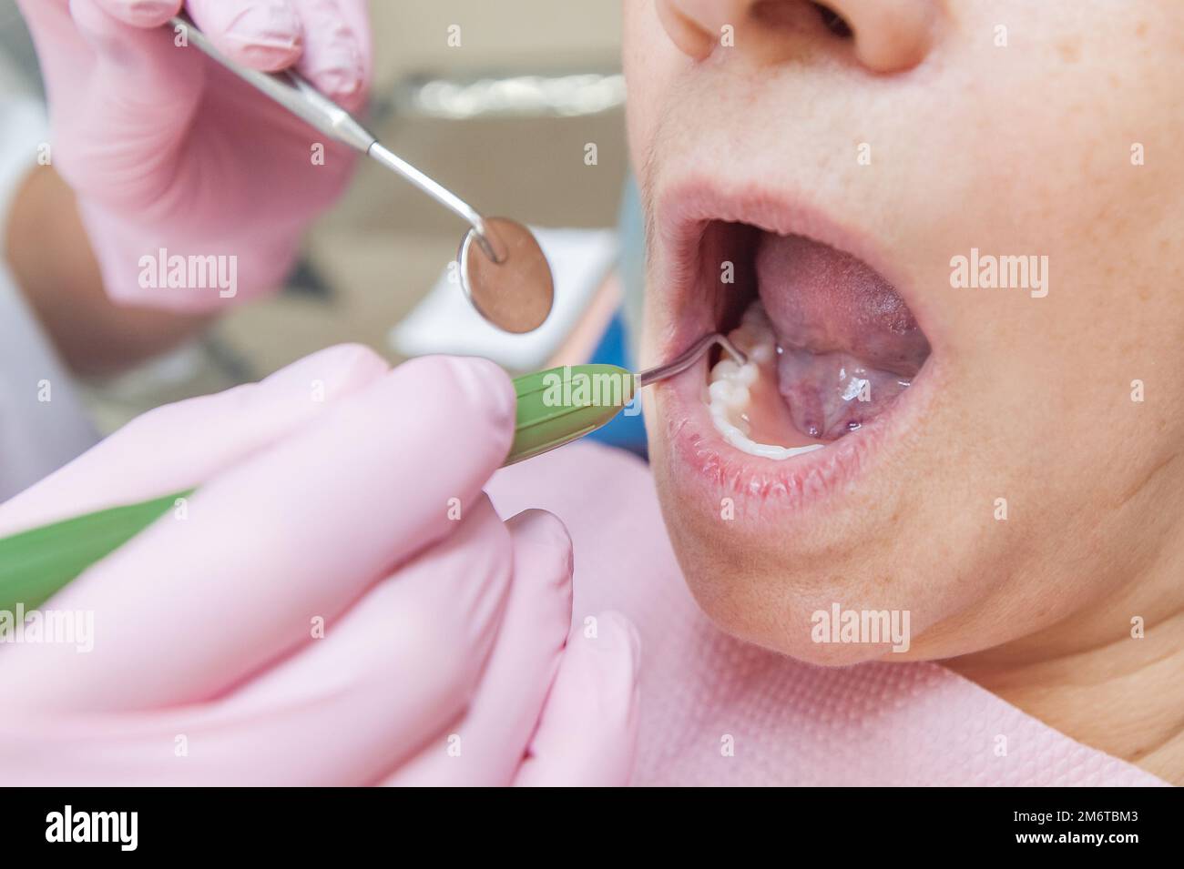 Prothesenset. Nahaufnahme von Zähnen. Zahnarzt untersucht einen Patienten Stockfoto