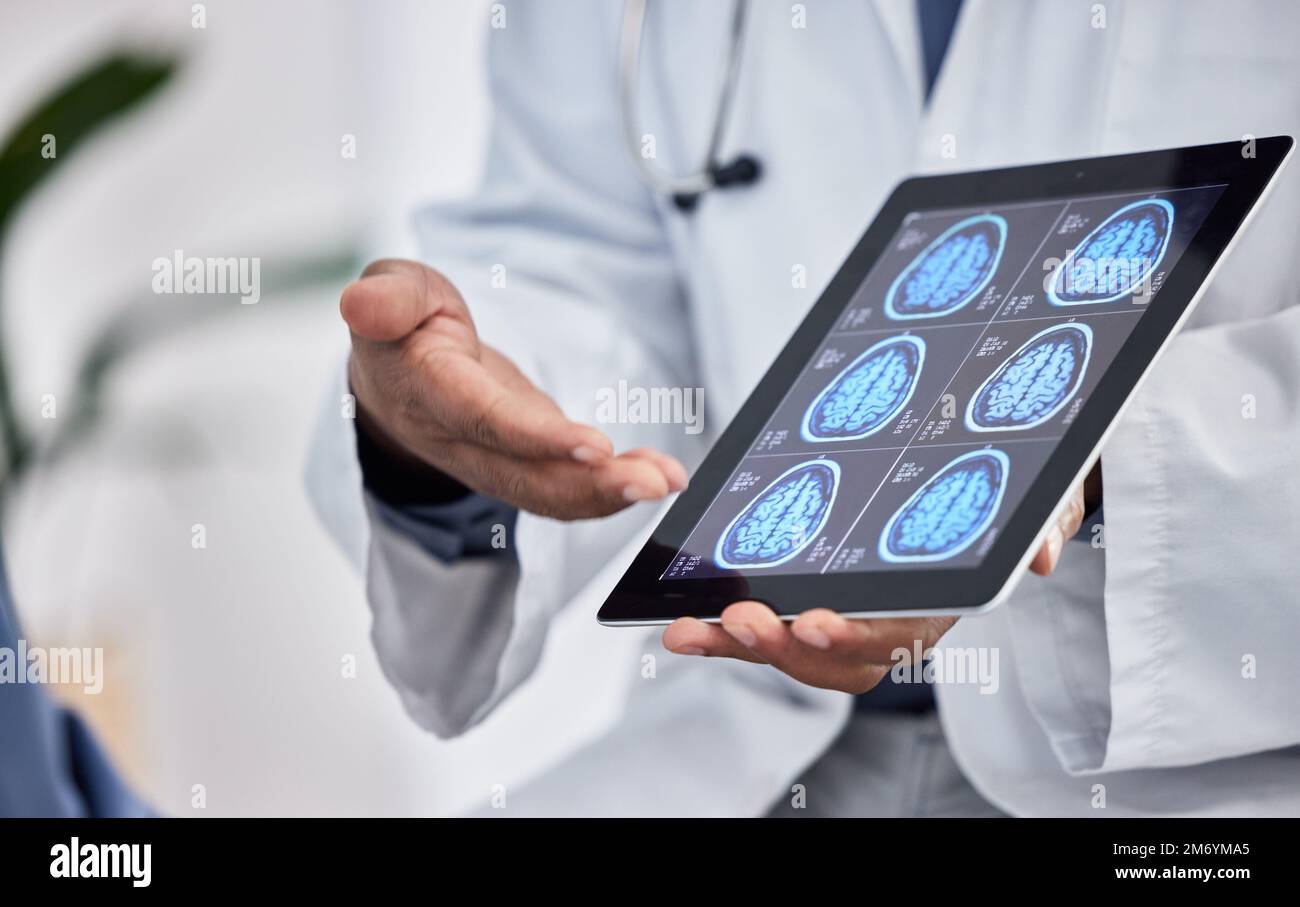 Neurologie, Gesundheitswesen und Arzt mit Tablet in den Händen für Gehirnforschung, Testergebnisse oder Krebsinnovation in Krankenhaus- oder Klinikberatung Stockfoto