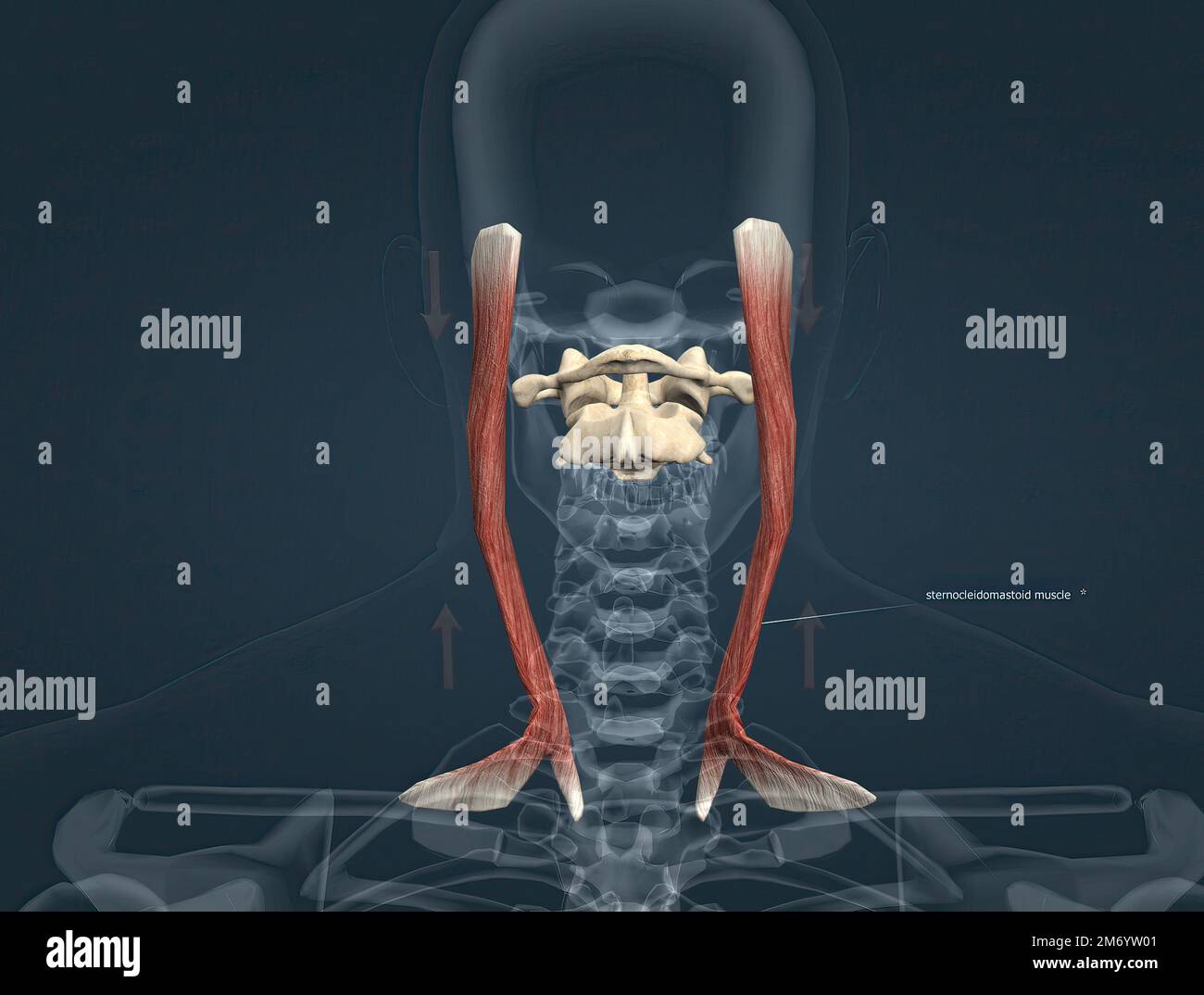 Sternocleidomastoid ist der oberflächlichste und größte Muskel im