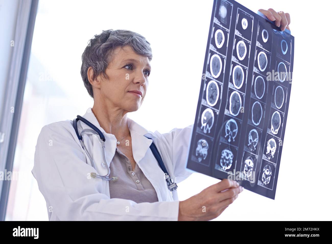 Wie wichtig es ist, einen CAT-Scan lesen zu können. Eine Ärztin, die Röntgenaufnahmen studiert. Stockfoto