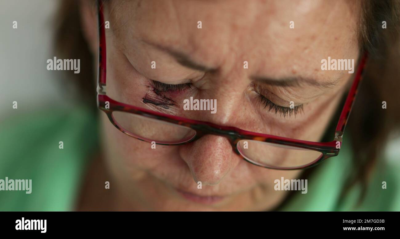 Ältere Frau mit blauen Flecken und Leseglas Stockfoto