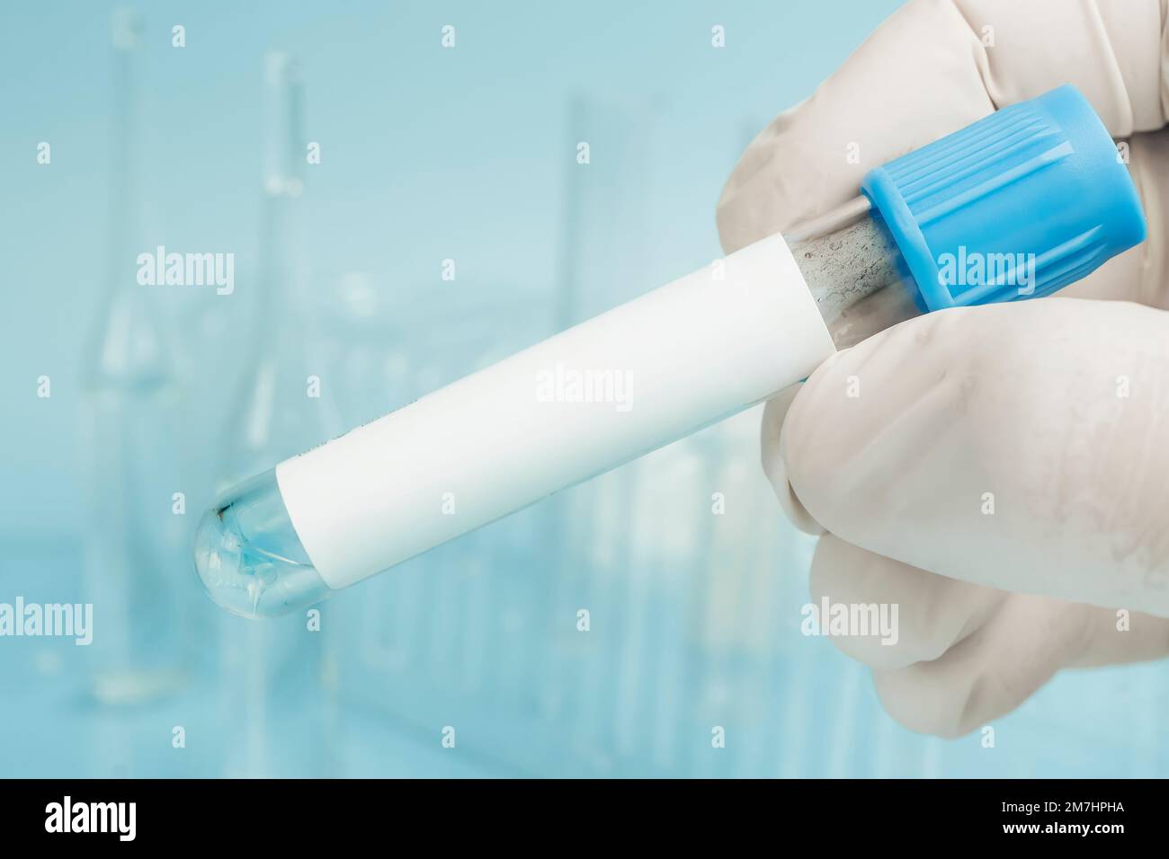 Bluttest. Reagenzgläser auf blauem Hintergrund. Durchsichtige Flüssigkeit in einem Glasrohr in der Hand einer Laboratoriumsgehilfin. DNA-Test. Labortests Stockfoto