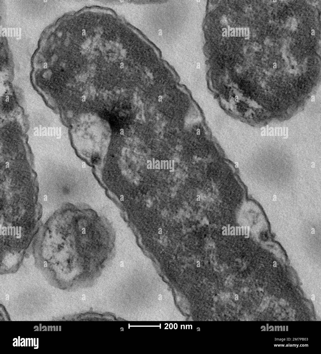 Escherichia coli (E.coli) unter Transmissionselektronenmikroskopie (TEM