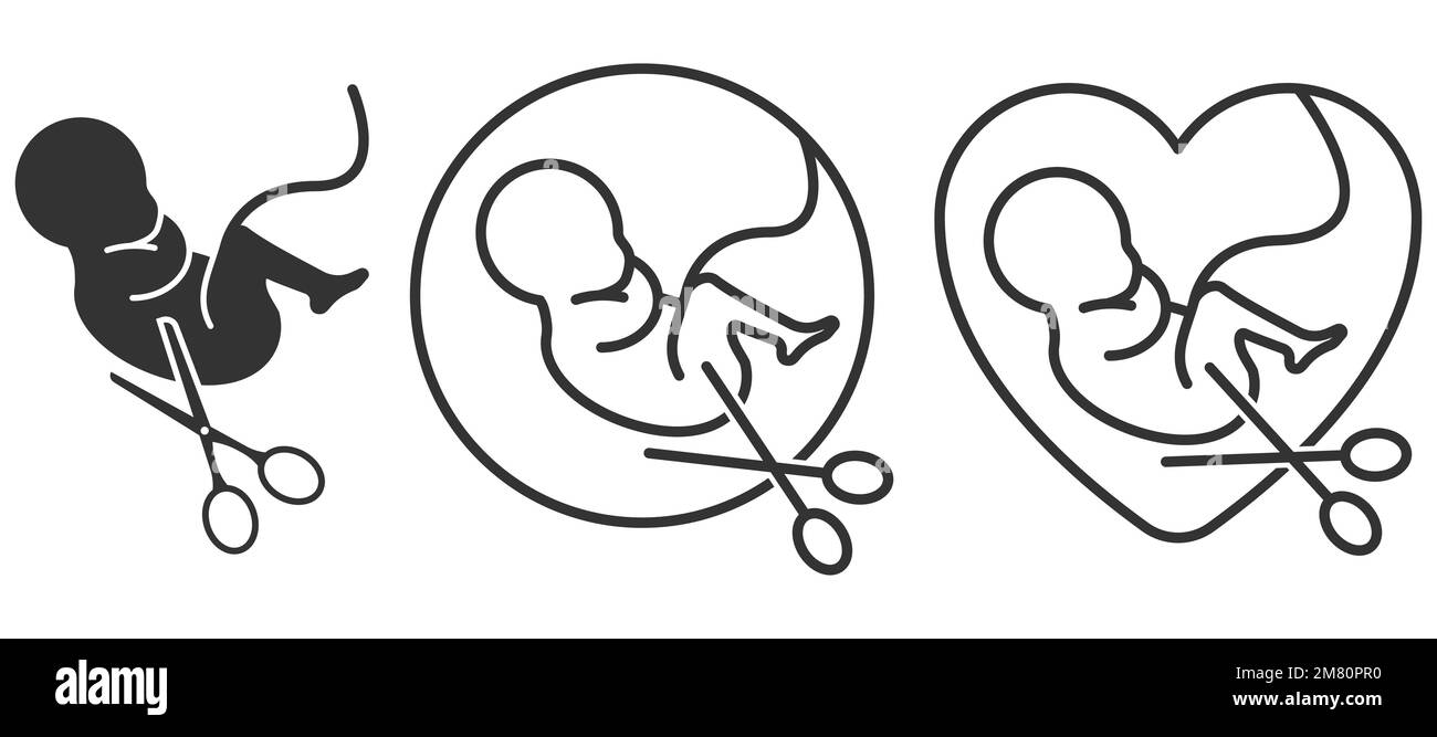 Embryo mit Schere. Abtreibungszeichen. Abtreibungskampagne Stoppen. Vektordarstellung. Eps 10. Stock Vektor
