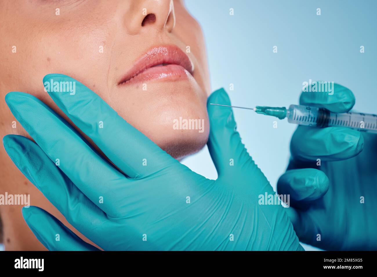 Botox, Hände- und Schönheitschirurgie mit einer Frau und einem Arzt im Studio auf blauem Hintergrund für Gesichtswechsel. Schönheit, Haut und Injektion beim Chirurgen Stockfoto