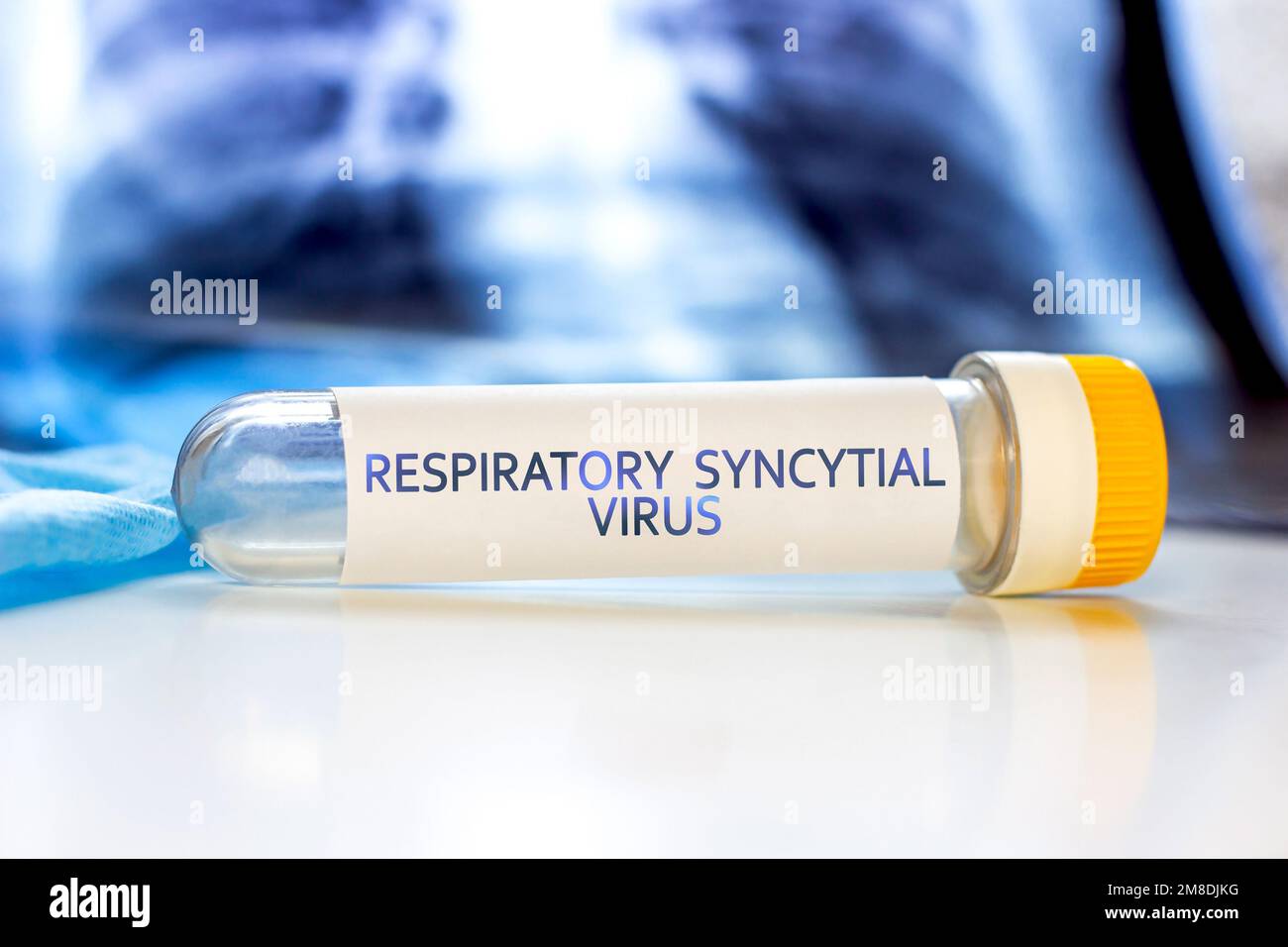 Respiratory-Syncytial-Virus mit Lungen-CT-Scan auf hellblauem Hintergrund. RSV-Krankheitskonzept. Stockfoto