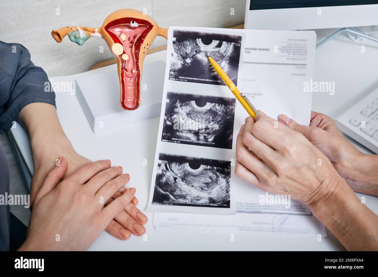 Gynäkologie, Frauengesundheit. Gynäkologe zeigt der Frau Ultraschall ihrer Eierstöcke beim Besuch in der Gynäkologie Stockfoto