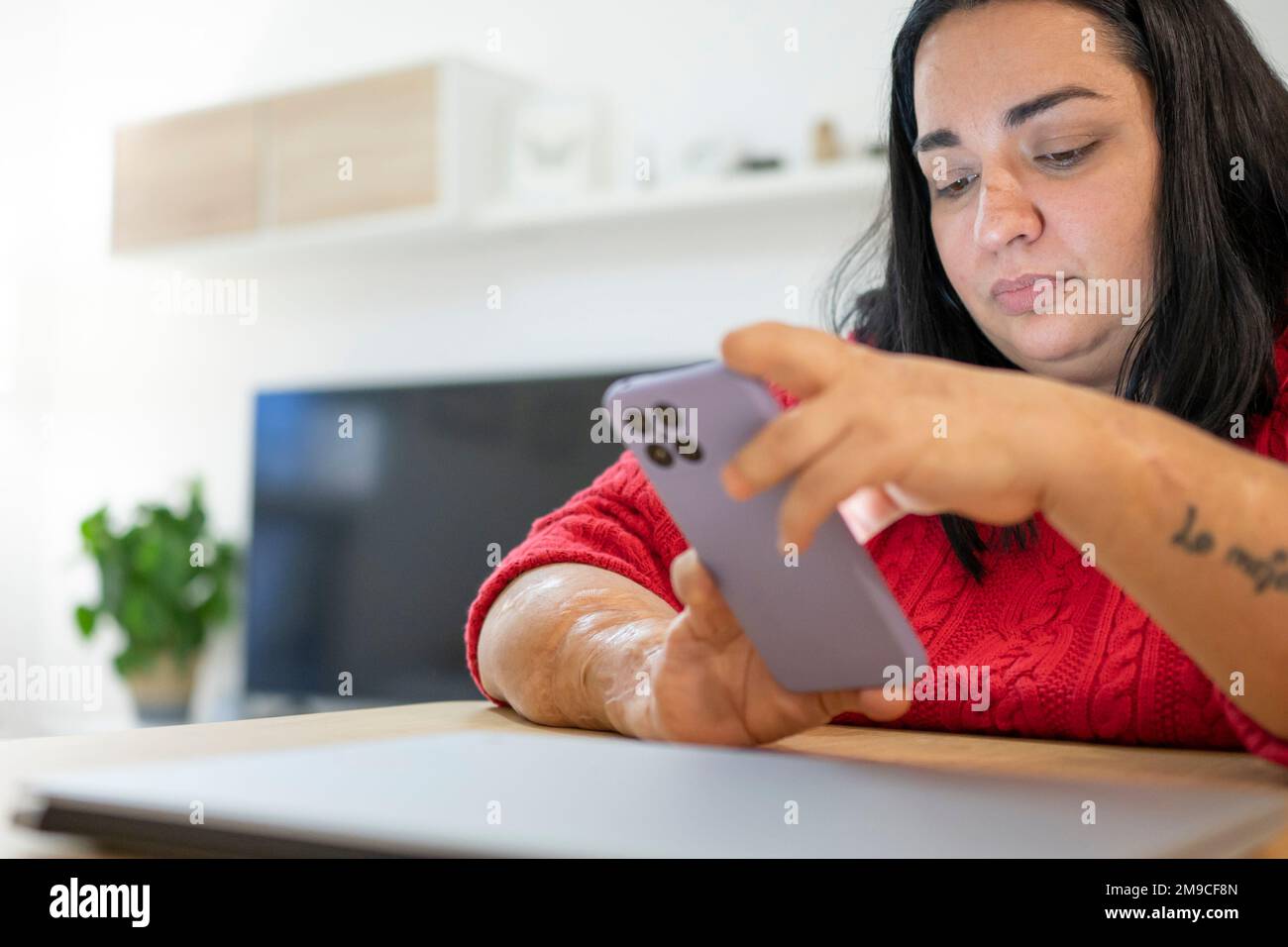 Eine kaukasische Frau mit körperlicher Behinderung, die ein Mobiltelefon benutzt. Stockfoto