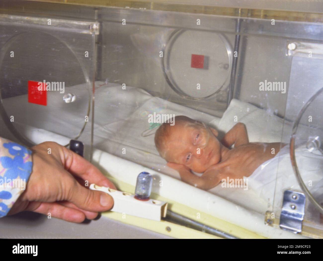 Ein Frühgeborenes Mädchen in einem Inkubator im Redhill Hospital, Surrey. Stockfoto