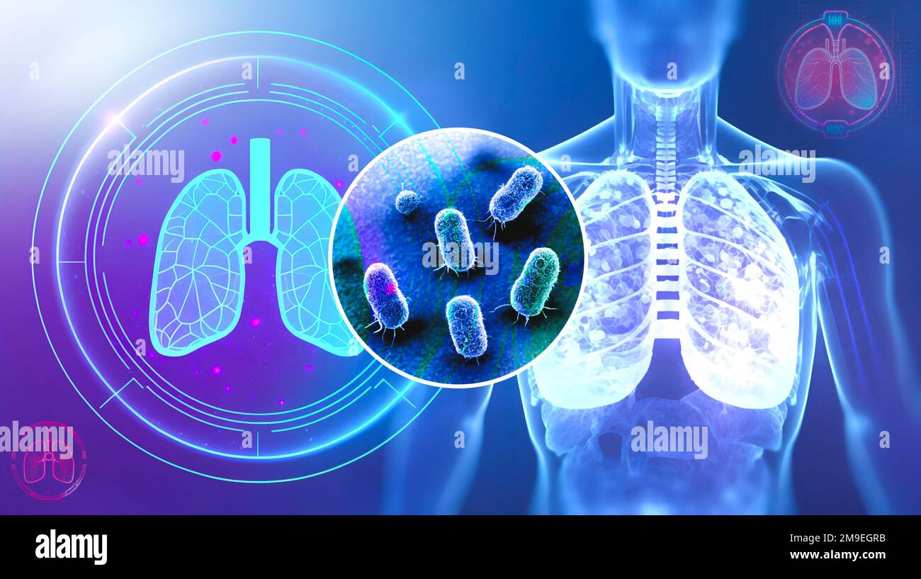 Tuberkulose (TB) Lungenerkrankung, Atemwegserkrankungen Konzept, TB-Impfstoff, 3D-Rendering Stockfoto