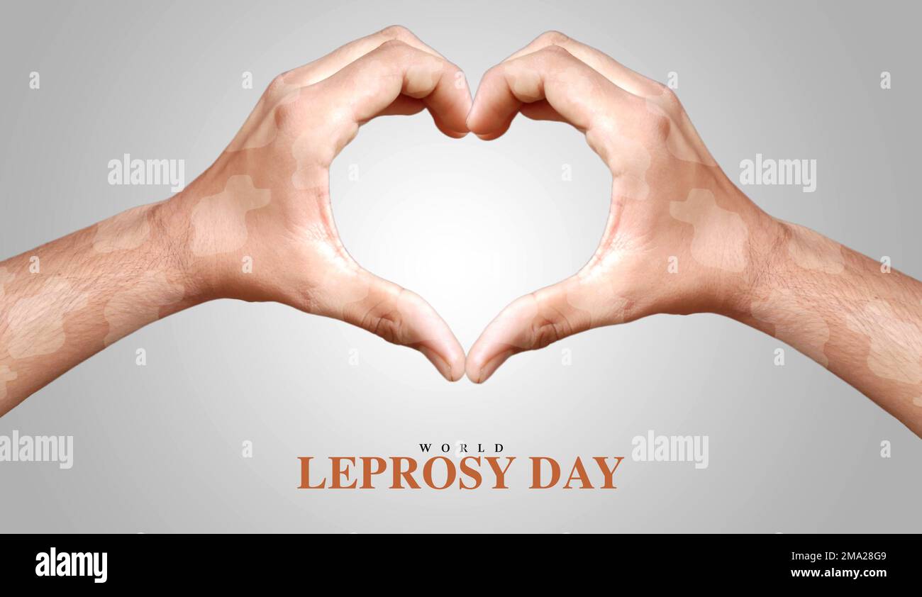 Kreatives Poster zum Lepra-Welttag mit herzförmigen Lepra-Händen Stockfoto