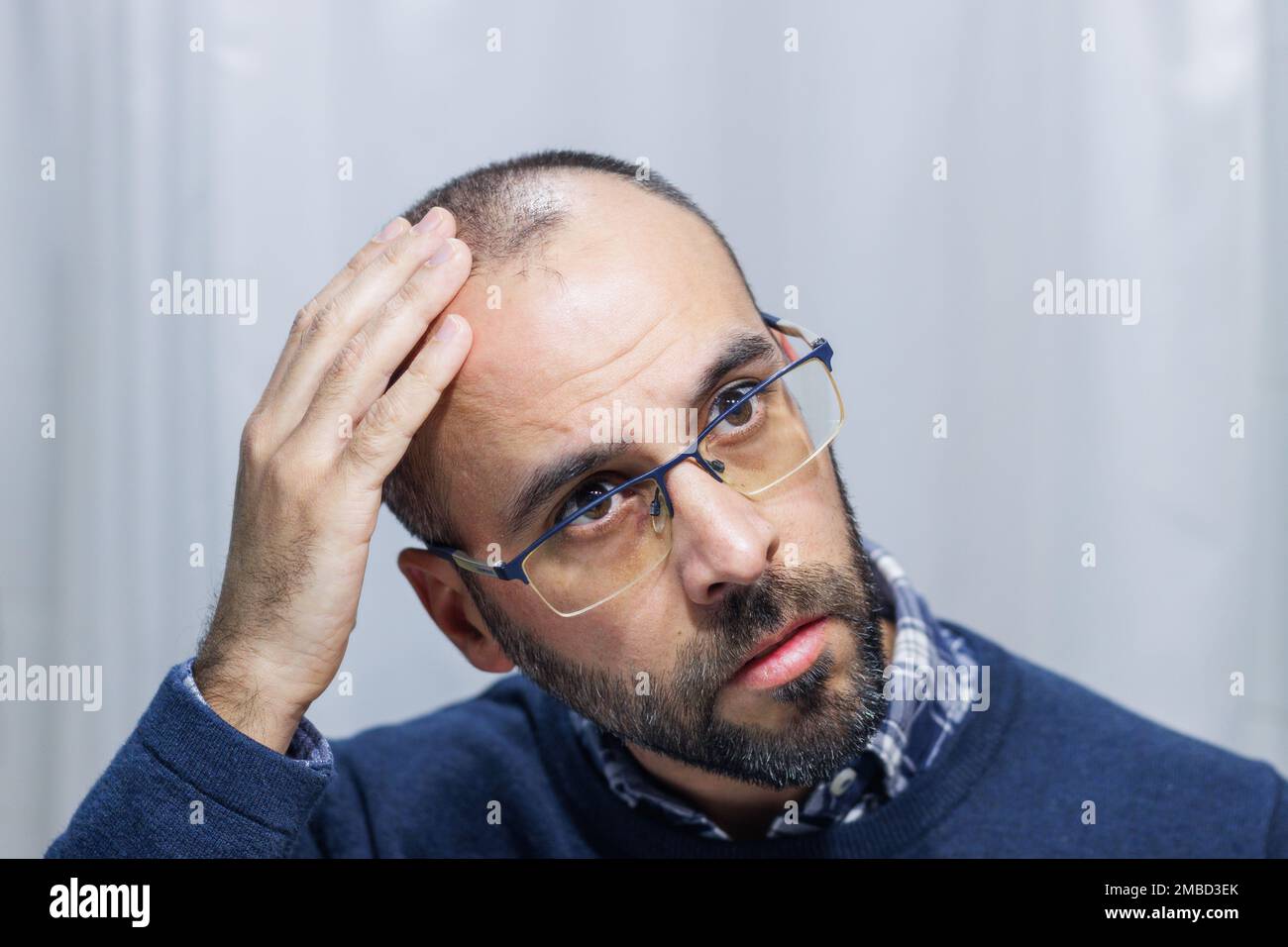 Junger Mann mit Alopezie, der Kopf und Haare im Spiegel sieht Stockfoto