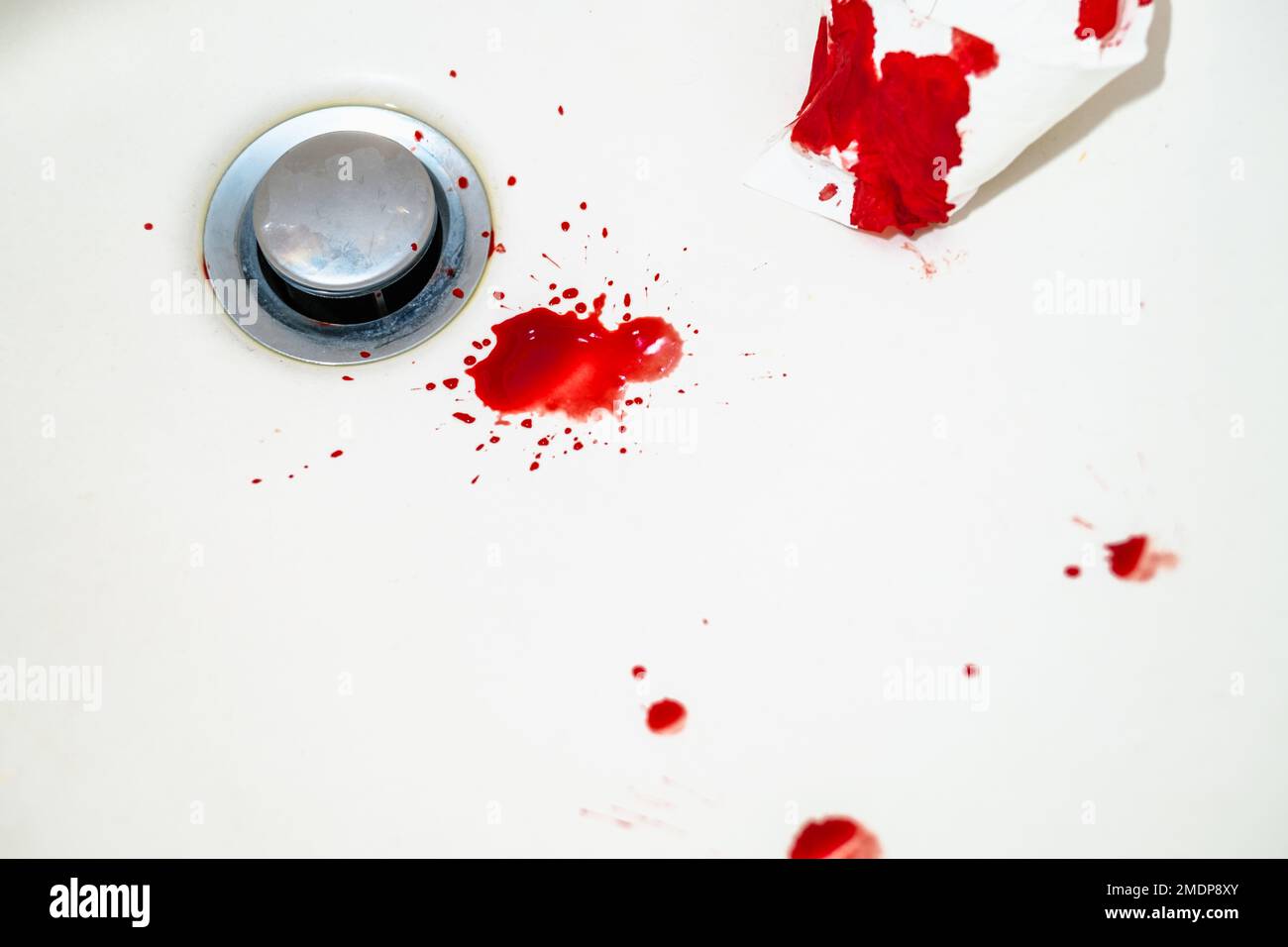 Rote Bluttropfen im weißen Waschbecken im Badezimmer. Echtes Blut als Spuren und Beweis eines Verbrechens. Begriff Nasenbluten, Verletzung, Gewalt, Mord oder Selbstmord. DNA. Stockfoto