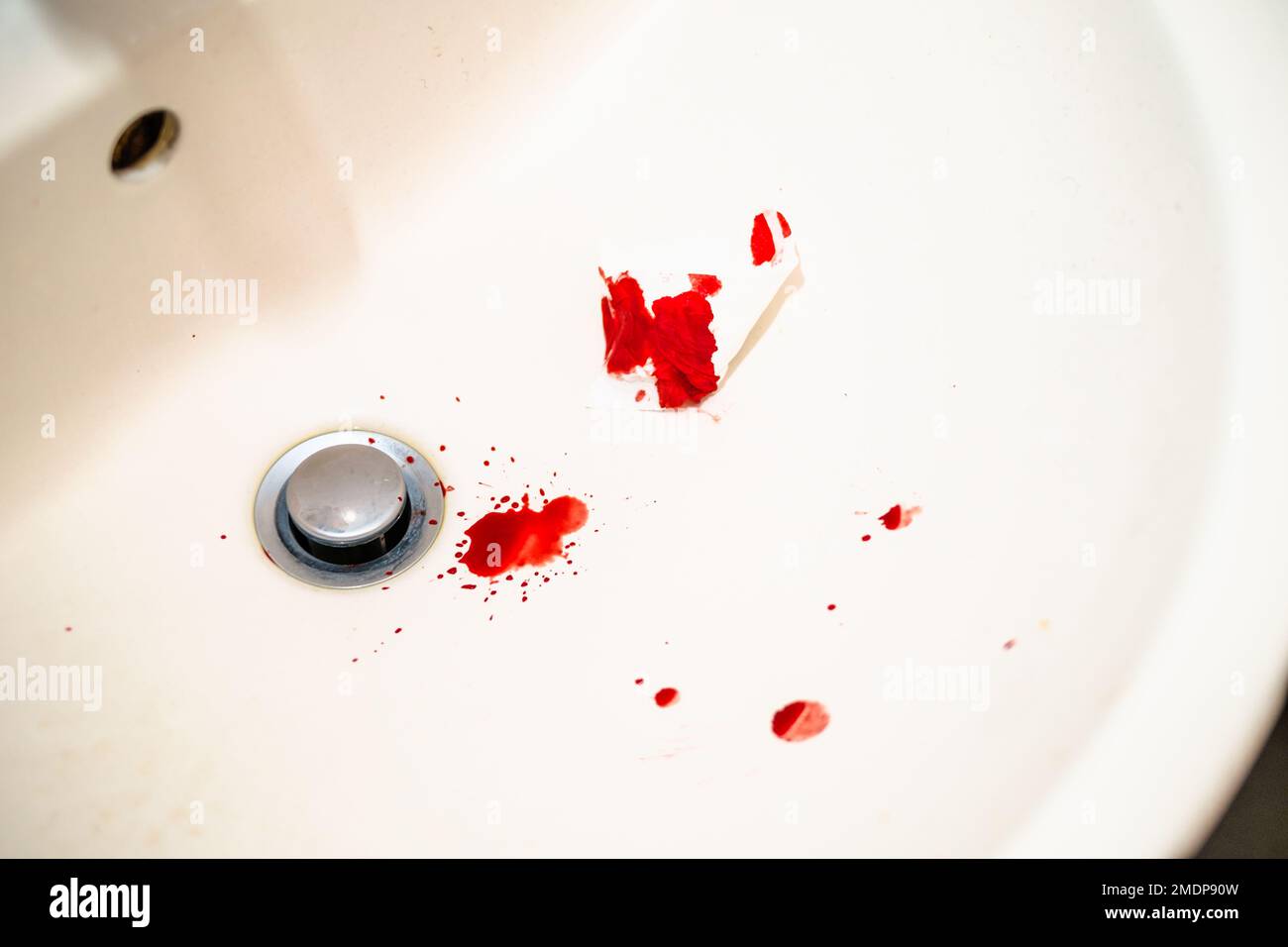 Rote Bluttropfen im weißen Waschbecken im Badezimmer. Echtes Blut als Spuren und Beweis eines Verbrechens. Begriff Nasenbluten, Verletzung, Gewalt, Mord oder Selbstmord. Blut Stockfoto