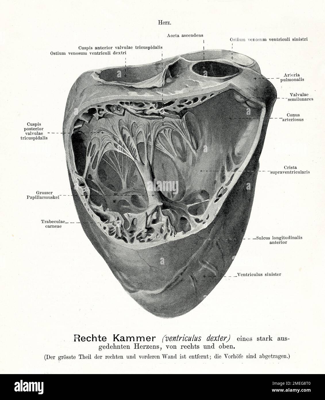Vintage-Darstellung der Anatomie des rechten Ventrikels eines stark dilatierten Herzens, rechte obere Ansicht mit deutschen anatomischen Beschreibungen Stockfoto