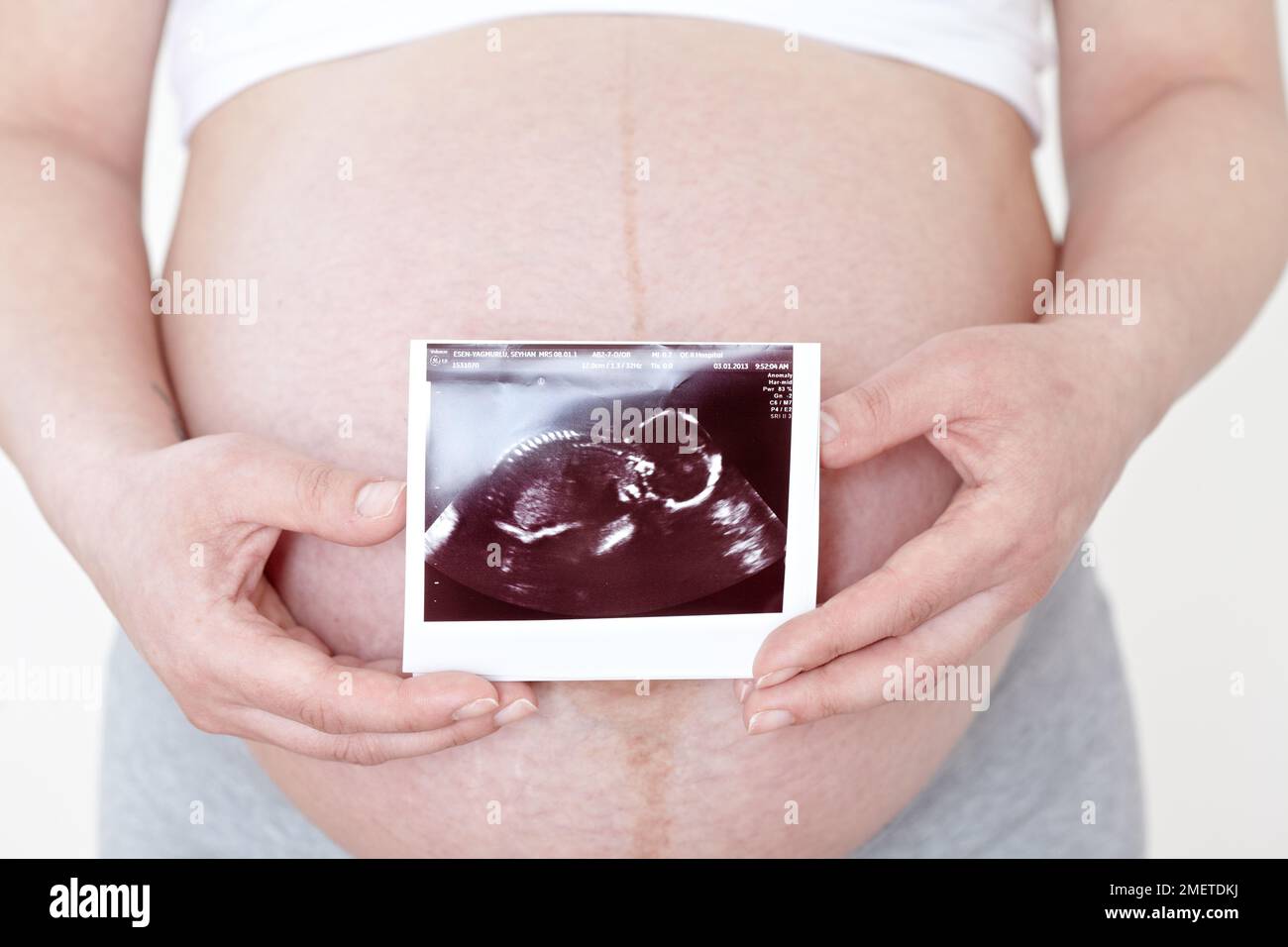 Schwangerin hält Ultraschalluntersuchung über ihrem Bauch Stockfoto