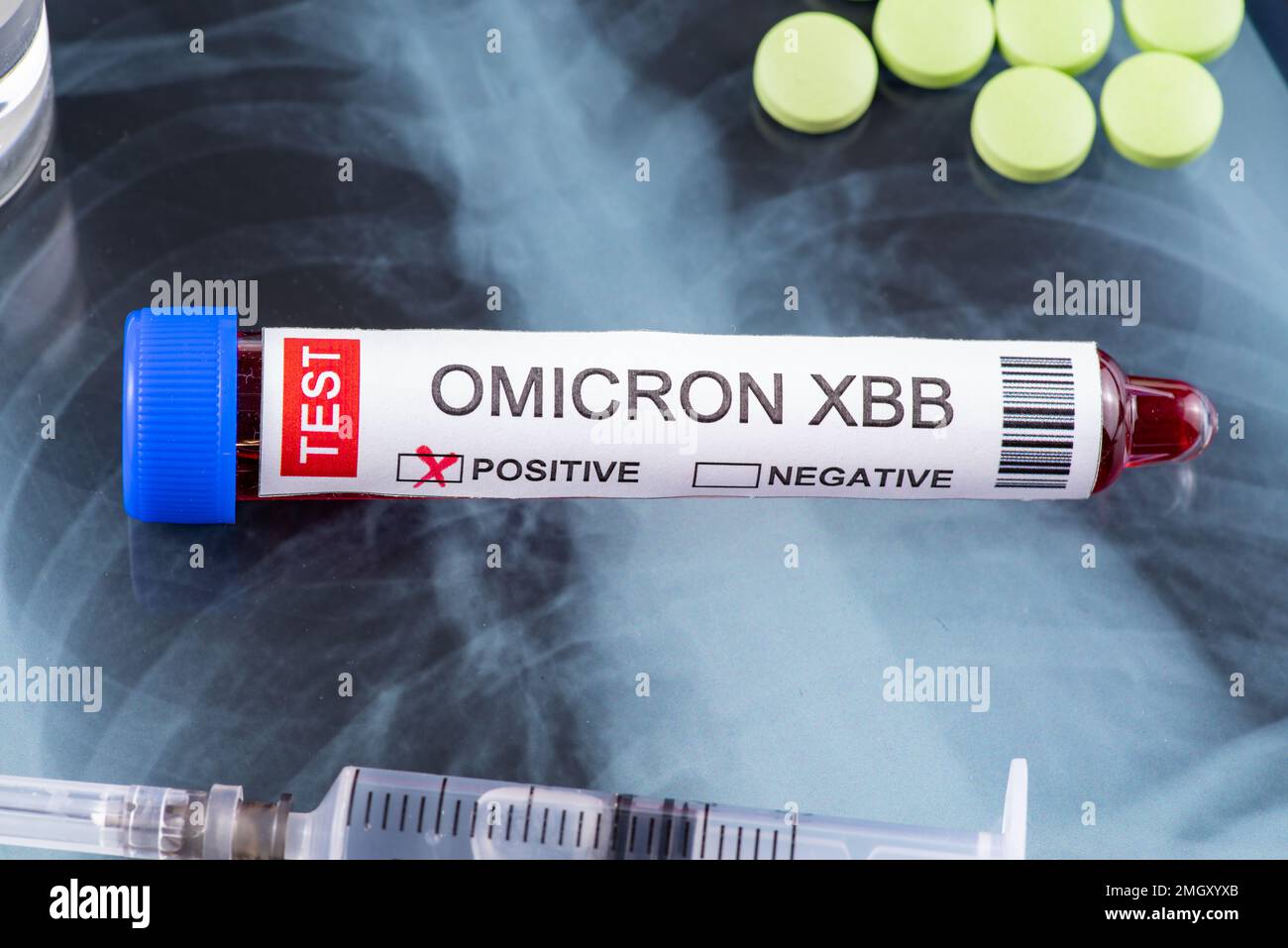 Reagenzglas mit der Kennzeichnung „OMICRON XBB Variant Test positive“ Stockfoto