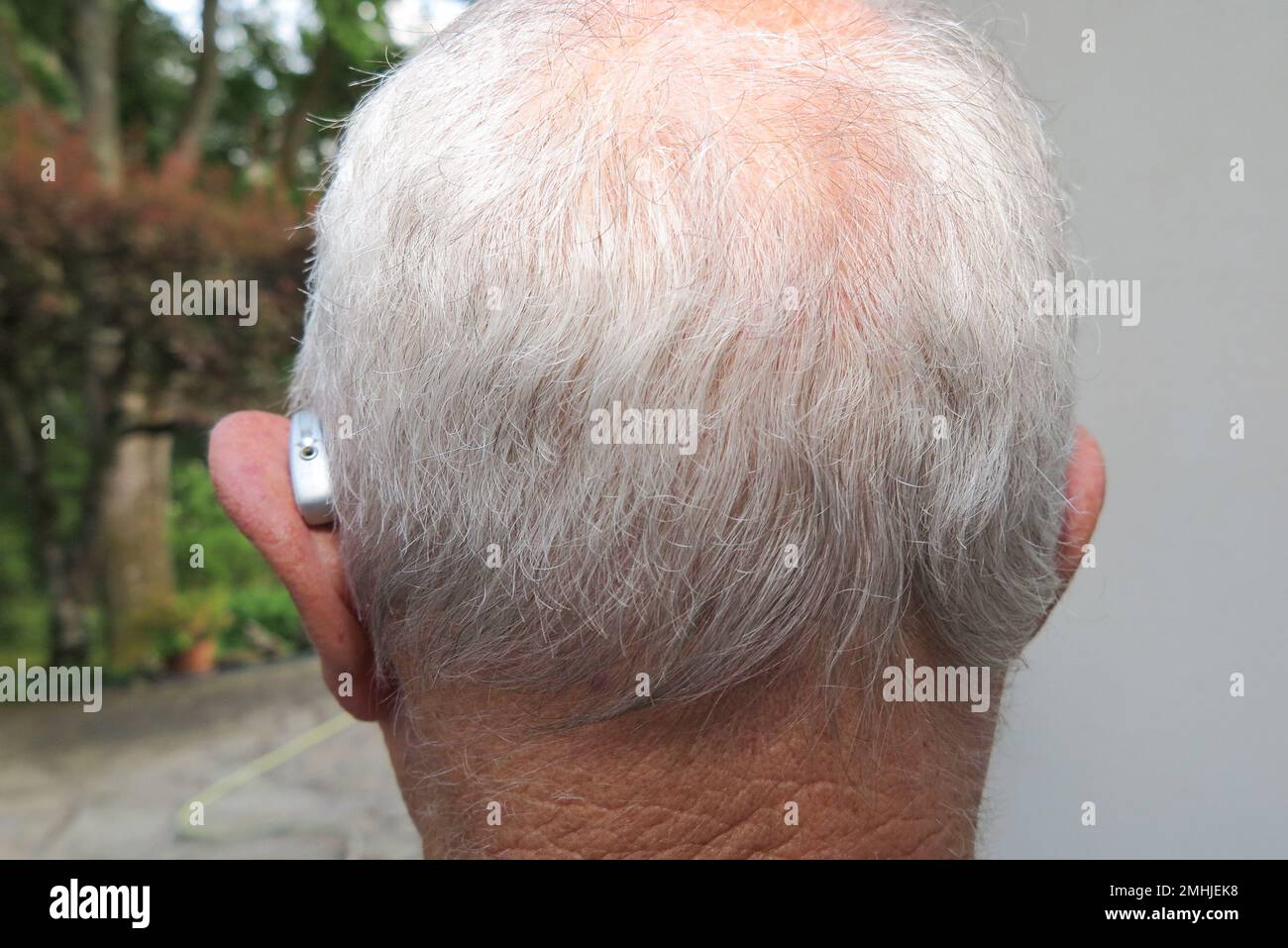 Rückansicht des Kopfes eines Glatzköpfchens mit Hörgerät für Taube und Schwerhörige Stockfoto
