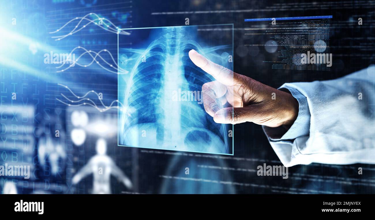 Arzt, Gesundheitswesen oder Finger-auf-Röntgen-Hologramm bei Tuberkulose-Virus, Krebsanalyse oder Asthma-Röntgen in der Nacht. Futuristische, abstrakte oder medizinische Lungen Stockfoto