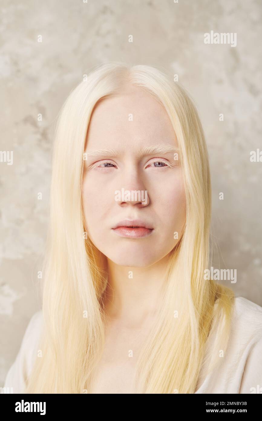 Jugendliches Albino-Mädchen mit langen glatten Haaren, das während der Fotosession vor der Kamera posiert, während es isoliert an der weißen Wand steht Stockfoto